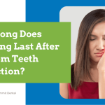 How Long Does Swelling Last After Wisdom Teeth Extraction?
