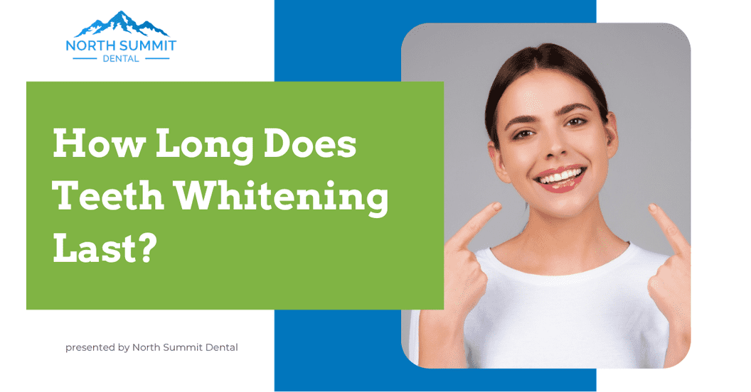 How Long Does Teeth Whitening Last?