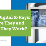 Dental Digital X-Rays What Are They and How Do They Work?