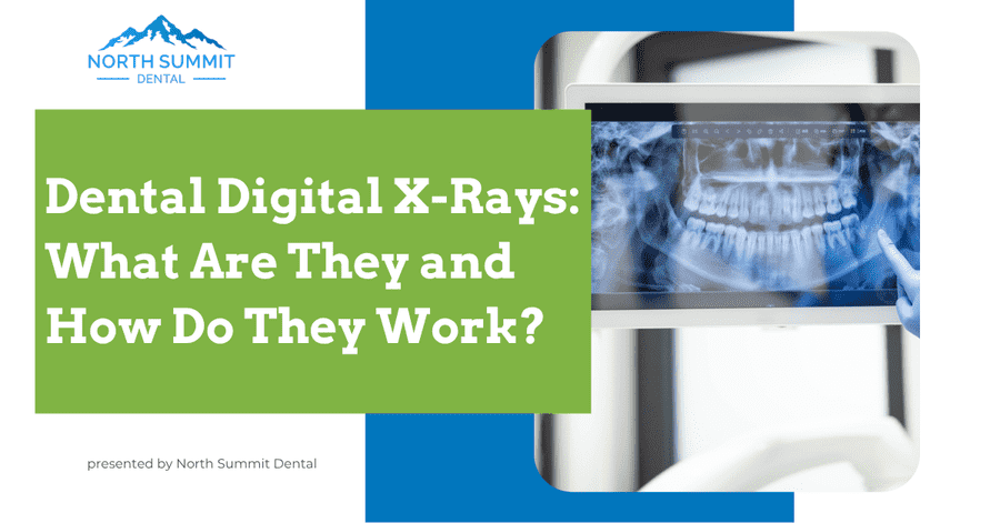 Dental Digital X-Rays What Are They and How Do They Work?