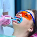 tooth coloured filling procedure burns lake