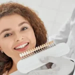 dental veneers burns lake